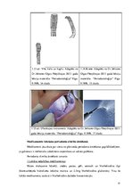 Diplomdarbs 'Periodonta slimību diagnostika un ārstēšanas metodes', 41.