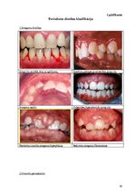 Diplomdarbs 'Periodonta slimību diagnostika un ārstēšanas metodes', 63.