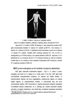 Referāts 'Cilvēka ģenētika', 7.