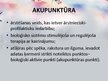 Prezentācija 'Akupunktūra', 4.