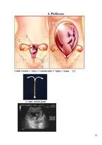 Referāts 'Grūtniecības pazīmes, kontracepcijas metodes vēsturē, attieksme pret abortu ārva', 25.