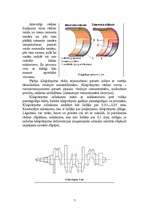 Referāts 'Kloķvārpstas remonts', 7.