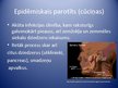 Prezentācija 'Epidēmiskais parotīts (cūciņas). Pertussis (garais klepus)', 2.