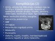 Prezentācija 'Epidēmiskais parotīts (cūciņas). Pertussis (garais klepus)', 11.
