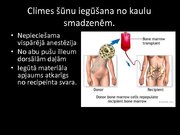 Prezentācija 'Kaulu smadzeņu transplantācija', 8.