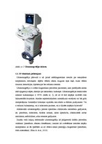 Referāts 'Ultrasonogrāfija (transabdomināla)', 2.