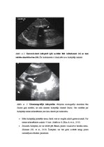 Referāts 'Ultrasonogrāfija (transabdomināla)', 4.