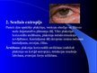 Prezentācija 'Plakstiņu patoloģijas', 27.