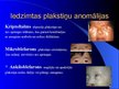 Prezentācija 'Plakstiņu patoloģijas', 39.