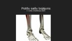 Prezentācija 'Potīšu saišu bojājums - 8. nedēļu rehabilitācijas plāns', 1.