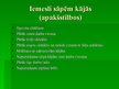 Prezentācija 'Kustību aparāta sāpes darbā ar datoru', 5.