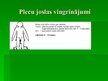 Prezentācija 'Kustību aparāta sāpes darbā ar datoru', 9.