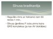 Prezentācija 'Lēkmjveidīgi sirds ritma traucējumi. Bradiaritmijas', 5.