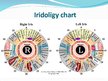 Prezentācija 'Iridology', 7.