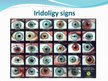 Prezentācija 'Iridology', 8.