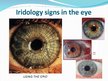 Prezentācija 'Iridology', 9.