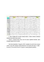 Diplomdarbs 'Negatīvās emocionālās nokrāsas attēlu ietekme uz sirdsdarbības frekvenci un vizu', 35.