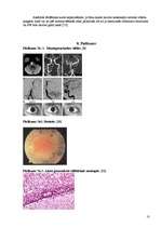 Konspekts 'Neirosifiliss', 10.