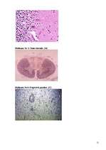 Konspekts 'Neirosifiliss', 12.