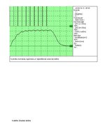 Paraugs 'Uzbudināmie audi', 6.