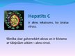 Prezentācija 'Hepatīts C un tā ārstēšanas metodes', 5.