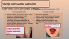 Prezentācija 'Vaskulīti', 6.