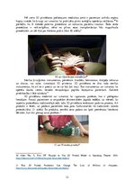 Referāts '3D tehnoloģijas medicīnā. Tehnoloģiju fizikālais darbības princips un to pieliet', 12.