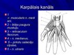 Referāts 'Karpālā kanāla sindroms', 3.