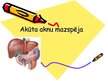 Prezentācija 'Akūta aknu mazspēja', 1.