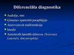 Prezentācija 'Demielinizējošās centrālās nervu sistēmas slimības', 26.