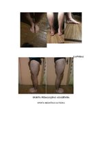 Konspekts 'Kāju un pēdu stāvokļa noteikšana', 1.