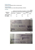 Paraugs 'Sirds automātija', 2.