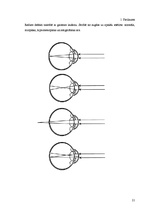 Referāts 'Lāzerstarojums un lāzeru pielietojums oftalmoloģijā', 21.