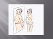 Prezentācija 'Anorexia Nervosa', 3.