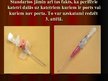 Prezentācija 'Perifēro vēnu kanilēšanas standartu analīze', 14.