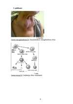 Referāts 'Zināšanas par onkoloģiskajām saslimšanām jauniešu un pieaugušo vidū', 52.