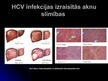 Prezentācija 'Hepatīts C', 9.