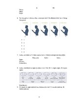 Referāts '"Text neck" sindroma izplatība fizioterapijas studentu vidē', 31.