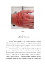 Referāts 'Ķīmisku vielu izrasīti nelaimes gadījumi', 5.