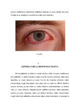 Referāts 'Ķīmisku vielu izrasīti nelaimes gadījumi', 6.