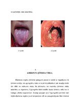 Referāts 'Ķīmisku vielu izrasīti nelaimes gadījumi', 7.