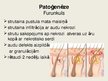 Prezentācija 'Furunkuls un karbunkuls', 5.