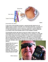 Referāts 'Redzes atgūšana neredzīgajiem ar mūsdienu tehnoloģiju palīdzību', 5.