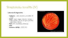 Prezentācija 'Angīnu diferenciāldiagnostika', 10.