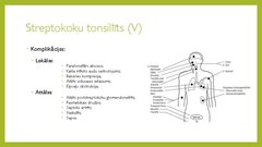 Prezentācija 'Angīnu diferenciāldiagnostika', 11.
