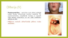 Prezentācija 'Angīnu diferenciāldiagnostika', 17.