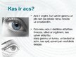 Prezentācija 'Acs', 2.
