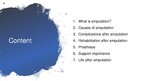 Prezentācija 'Rehabilitation after Amputation', 2.