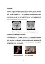 Referāts 'Radioaktivitāte izmantojama arī cilvēku labā', 25.