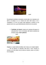 Referāts 'Tetovējumu ietekme uz cilvēku veselību', 7.